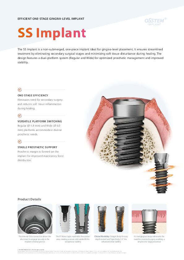 Flyer | SS Implant System | English