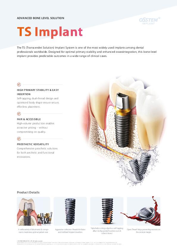 Flyer | TS Implant System | English