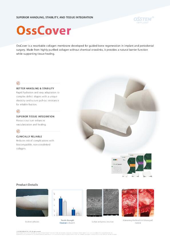 Flyer | OssCover | English