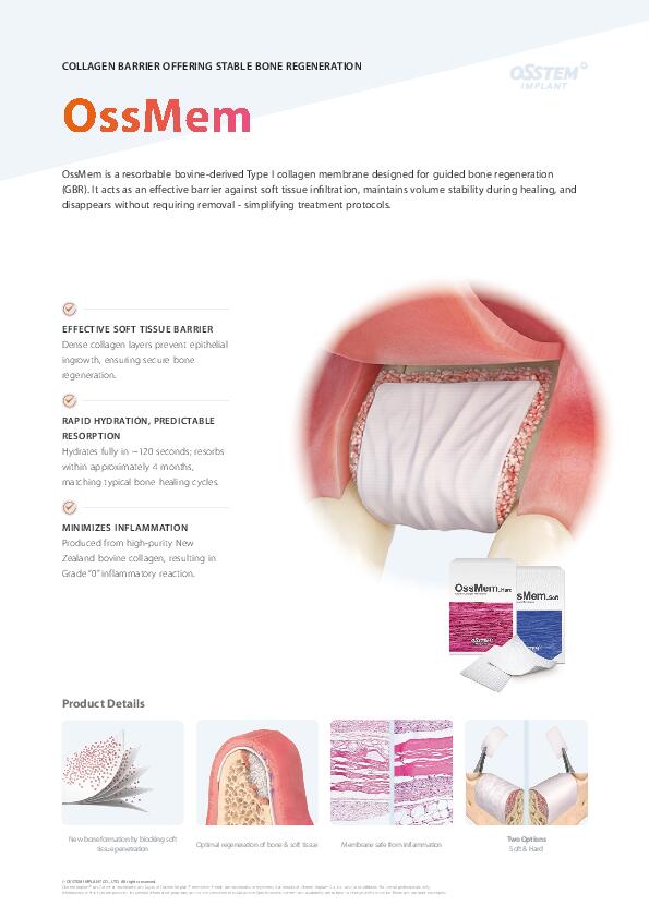 Flyer | OssMem | English