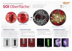 20211112_SOI-Surface_ger-thumbnail.jpg